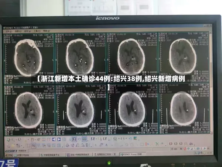 【浙江新增本土确诊44例:绍兴38例,绍兴新增病例】-第2张图片