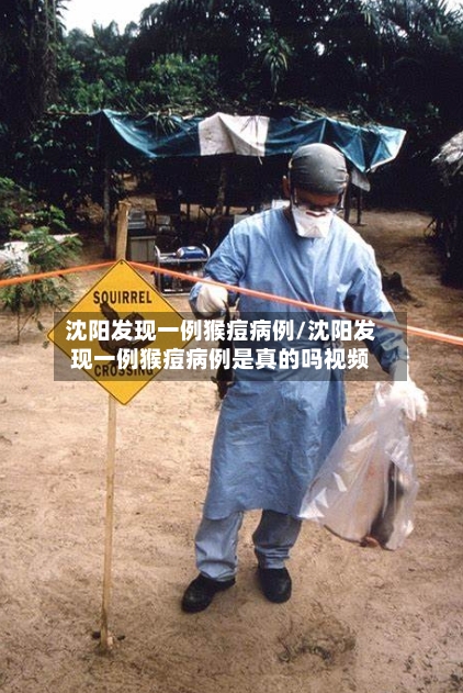 沈阳发现一例猴痘病例/沈阳发现一例猴痘病例是真的吗视频-第2张图片