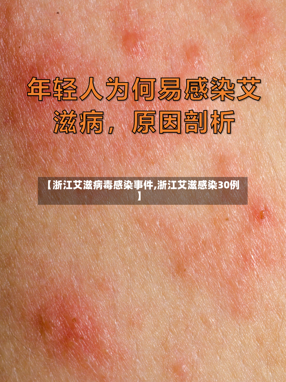 【浙江艾滋病毒感染事件,浙江艾滋感染30例】