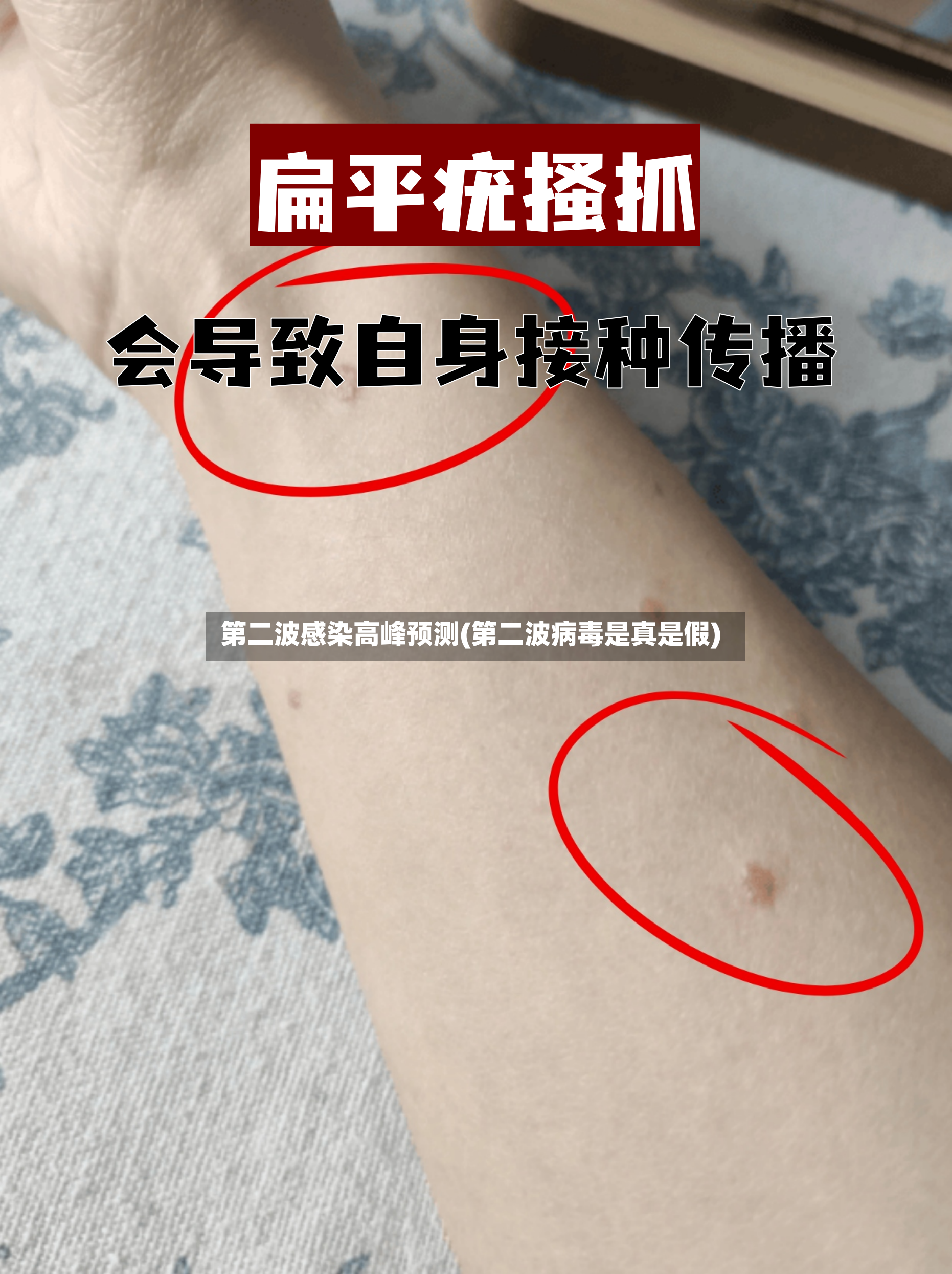 第二波感染高峰预测(第二波病毒是真是假)-第2张图片