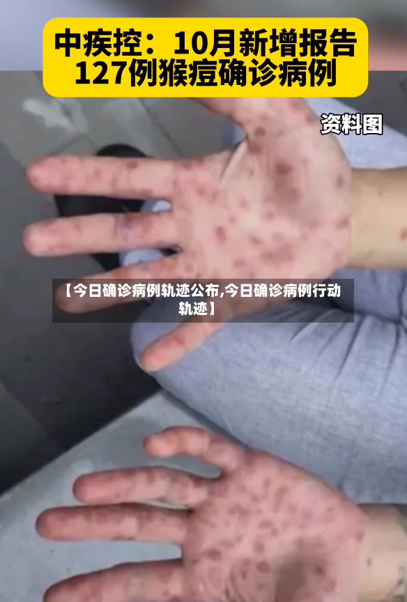 【今日确诊病例轨迹公布,今日确诊病例行动轨迹】-第2张图片