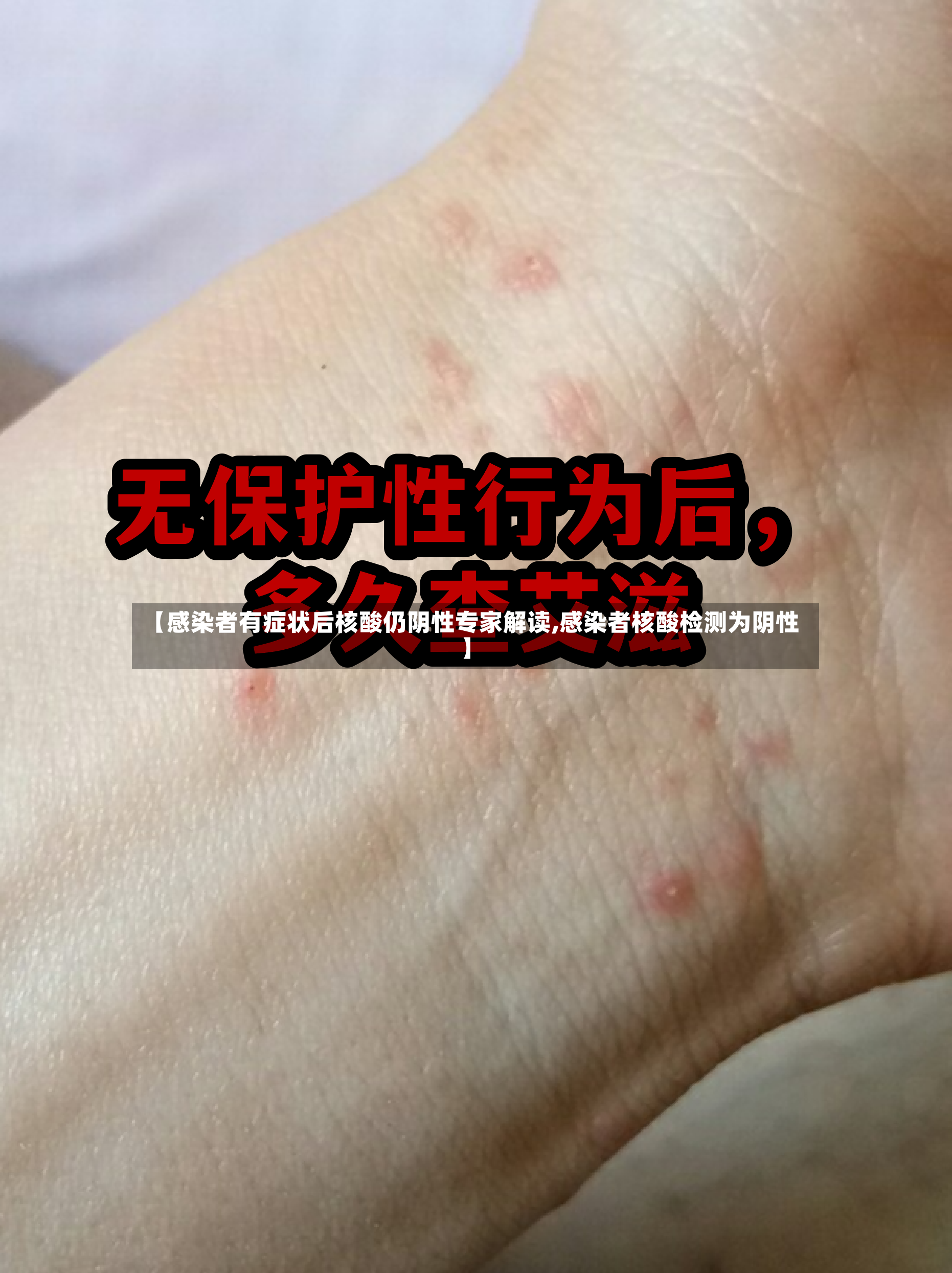 【感染者有症状后核酸仍阴性专家解读,感染者核酸检测为阴性】-第3张图片