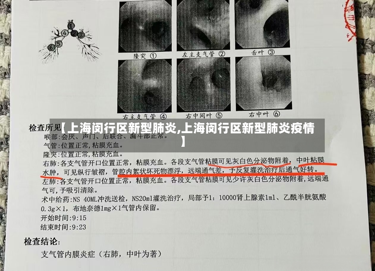 【上海闵行区新型肺炎,上海闵行区新型肺炎疫情】-第2张图片
