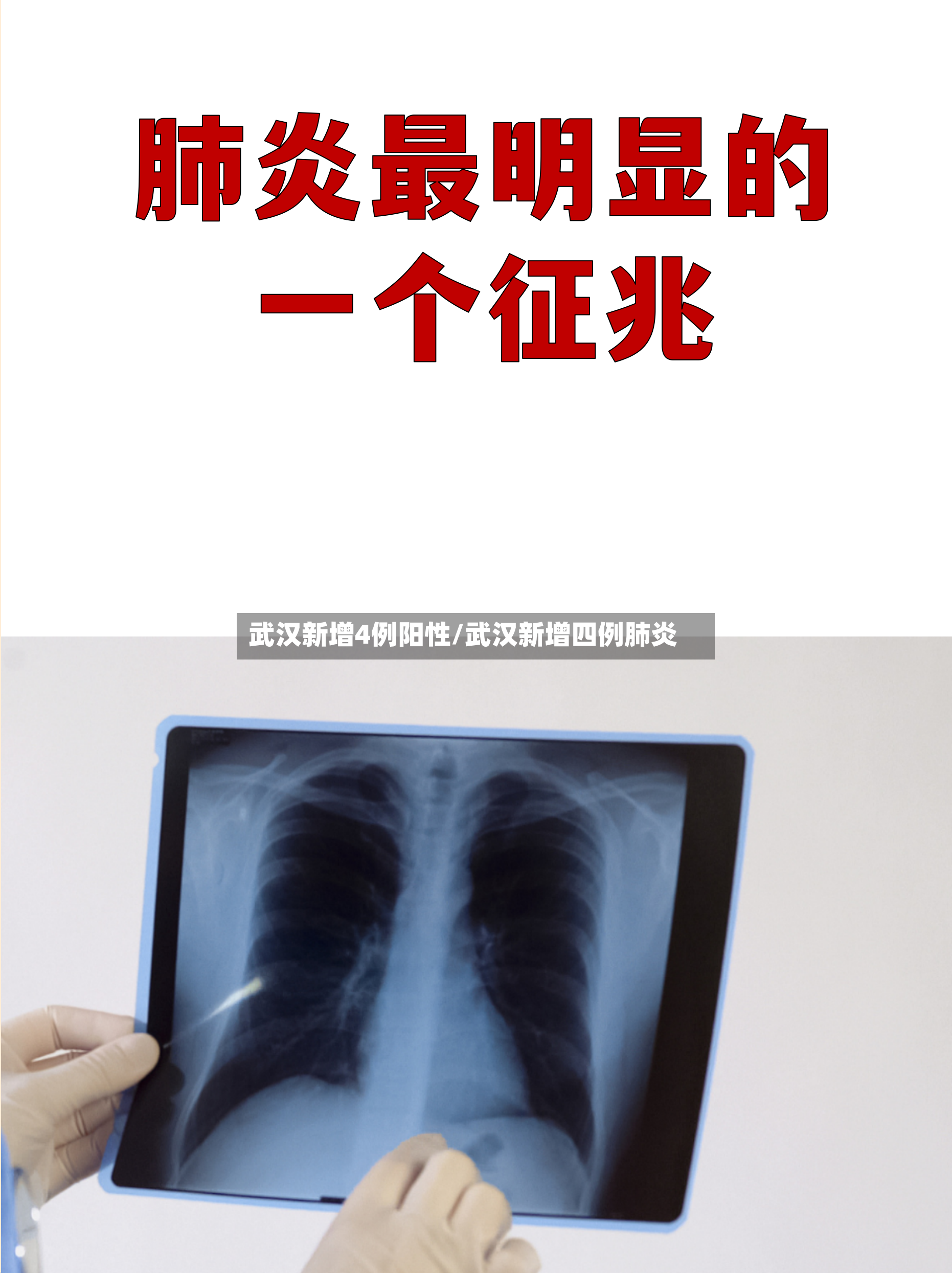 武汉新增4例阳性/武汉新增四例肺炎-第2张图片