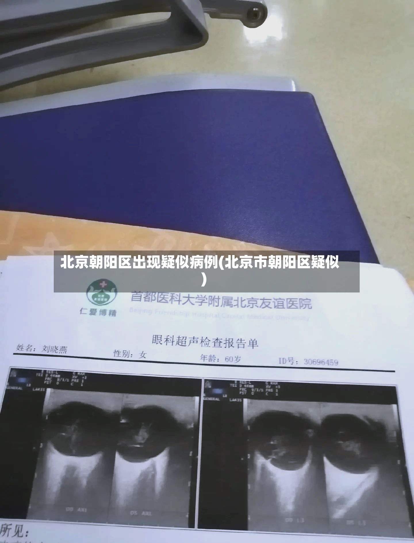 北京朝阳区出现疑似病例(北京市朝阳区疑似)-第3张图片