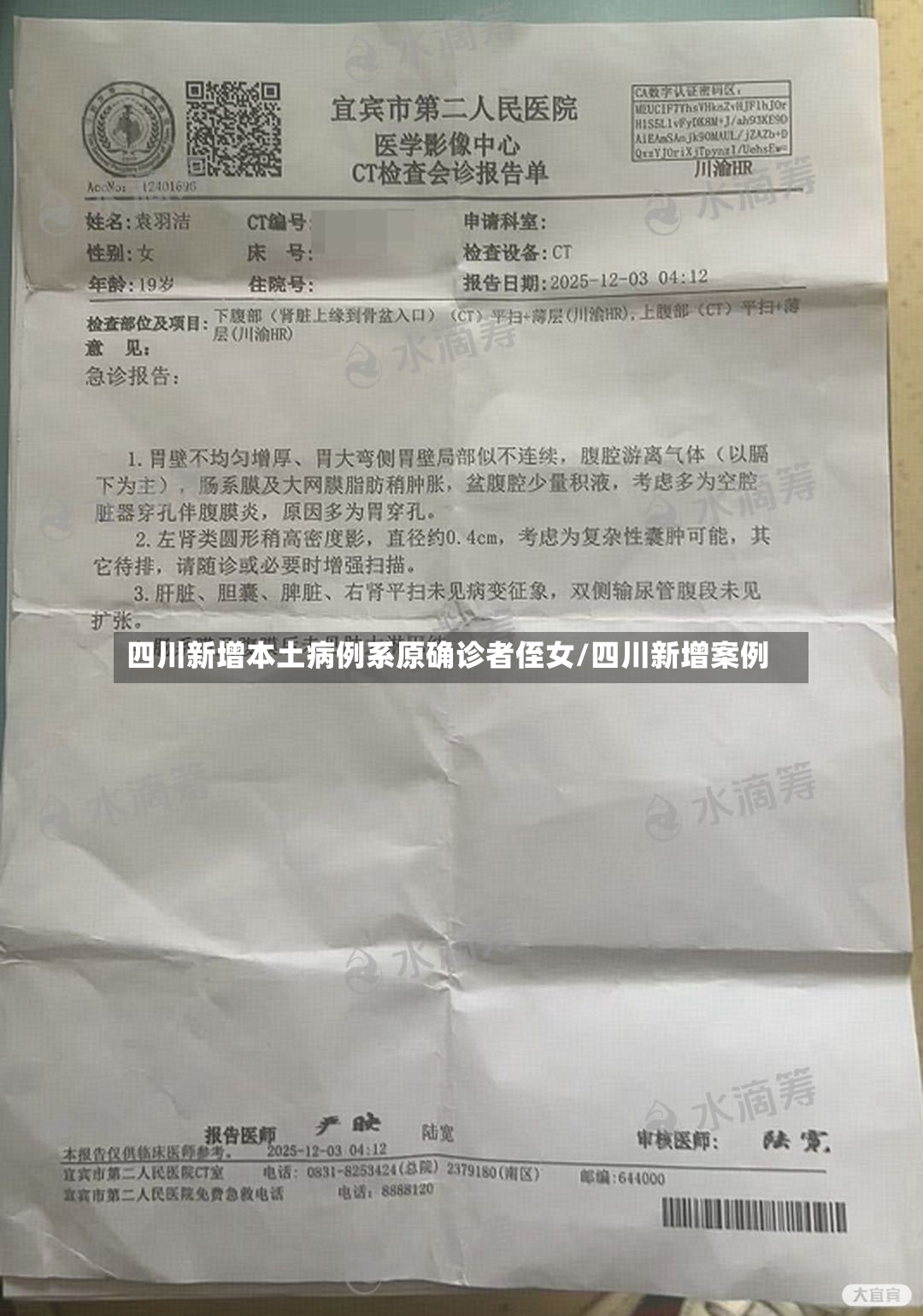 四川新增本土病例系原确诊者侄女/四川新增案例