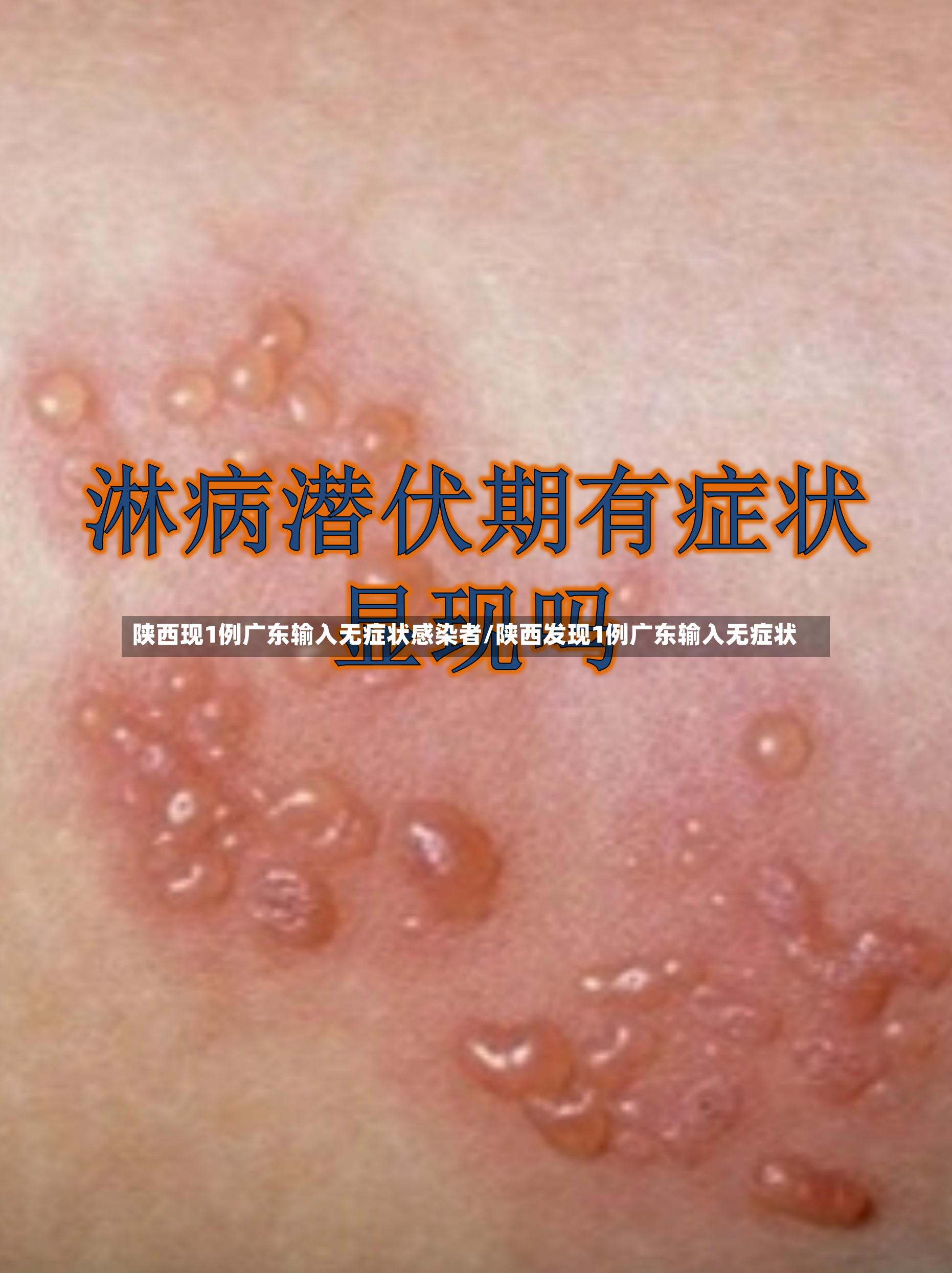 陕西现1例广东输入无症状感染者/陕西发现1例广东输入无症状-第3张图片